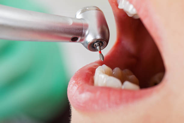 Best Urgent Tooth Repair  in Golden Shores, AZ